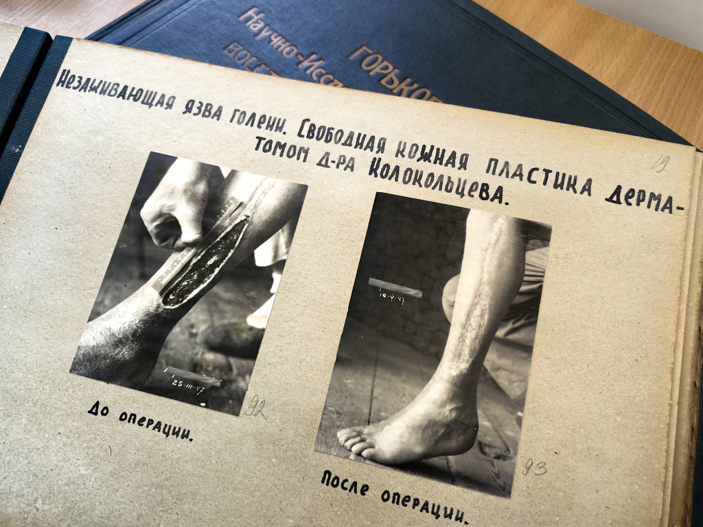 Применение дерматома.jpg
