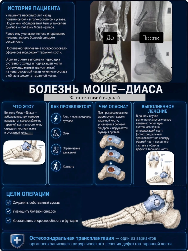 Болезнь Моше—Диаса