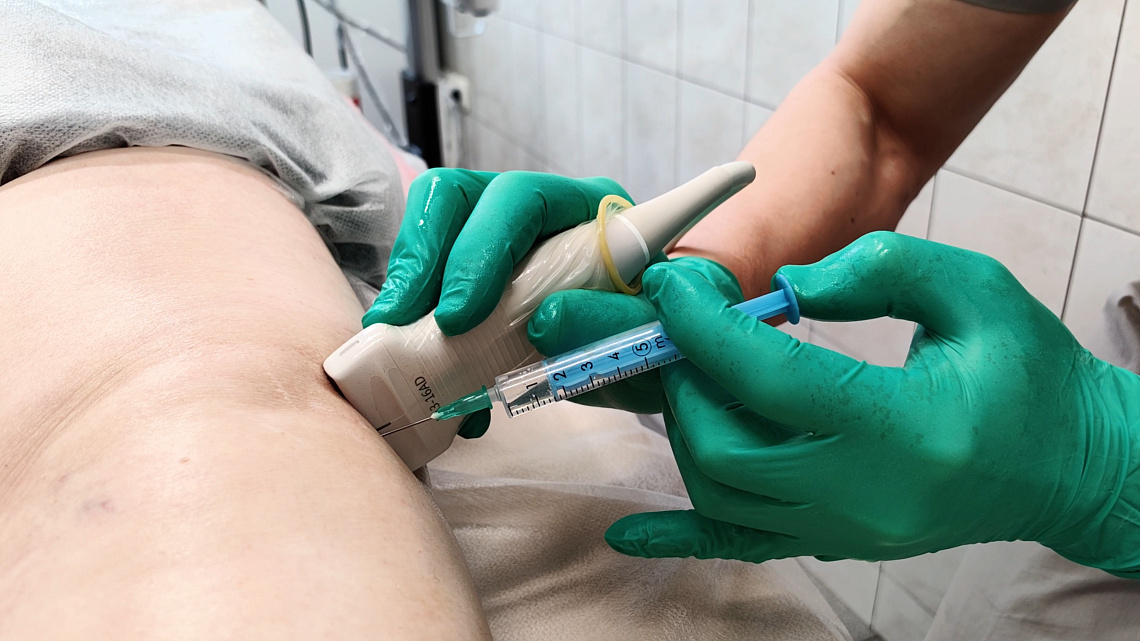 10 вопросов о внутрисуставных инъекциях с гиалуроновой кислотой